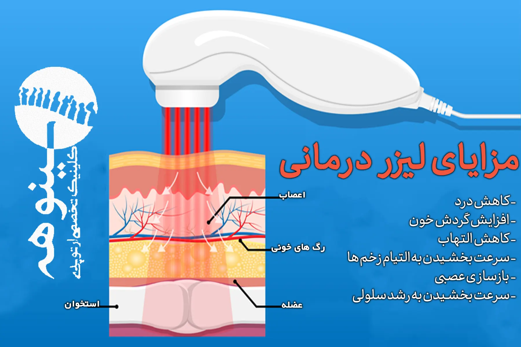 مزایای لیزر درمانی